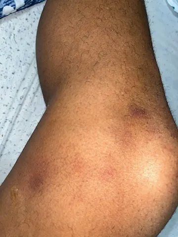 Aulsbrook Car & Truck Wreck Injury Lawyers Grand Prairie Picture 6